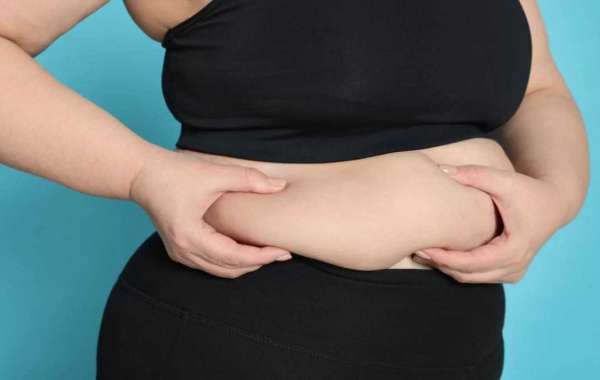Bariatric Surgery in Islamabad – A Medical Path Toward Permanent Weight Control with Enfield Royal Clinic