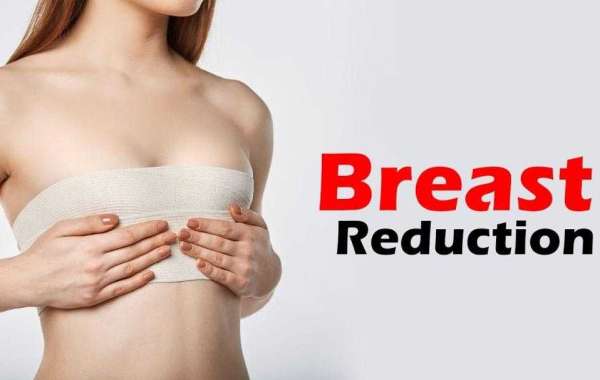 Beautiful & Comfortable: Breast Reduction in Islamabad