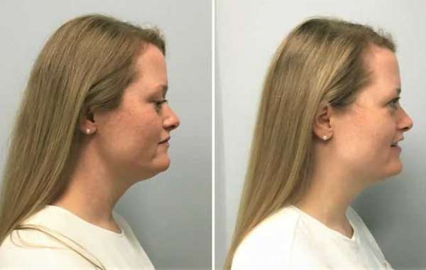 Article Picture
