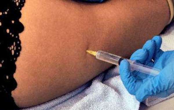 Article Picture