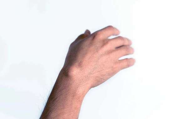 Article Picture