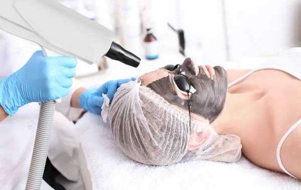 Why Spectra Laser Carbon Peel Is Becoming the Go-To Hollywood Facial