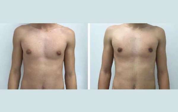 Article Picture