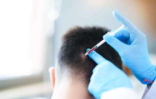 Advanced PRP Hair Treatment in Riyadh for Healthier Hair Growth