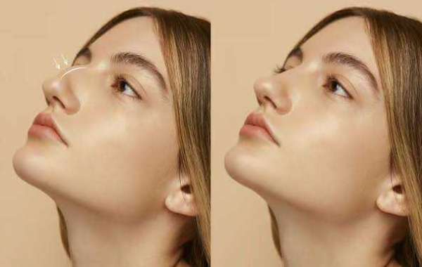 Article Picture