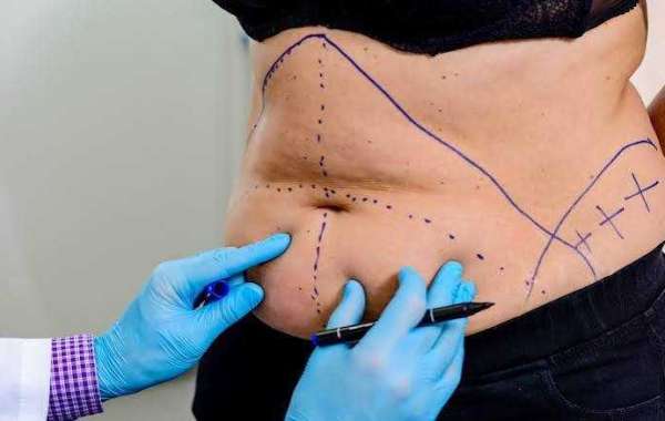 Refine Your Shape With Care