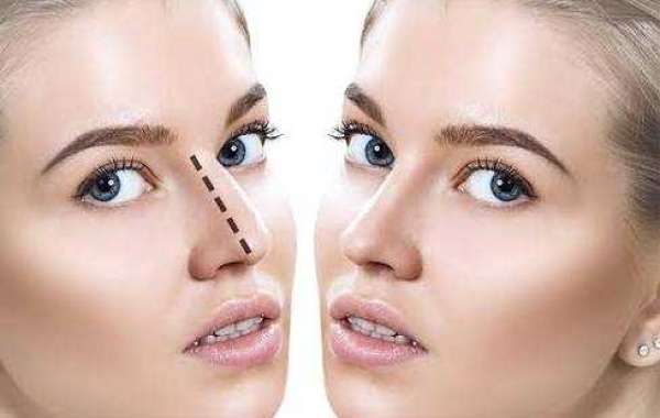 Top Clinics Offering Advanced Nose Surgery Cost in Dubai