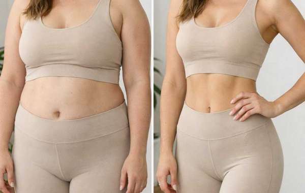 Mommy Makeover Dubai: How to Choose the Right Combination of Procedures