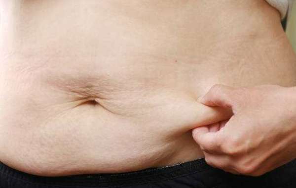 How to Find a Qualified Tummy Tuck in Riyadh Specialist