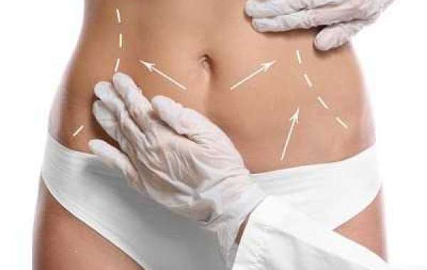 Who Is Too Young for Tummy Tuck Surgery?