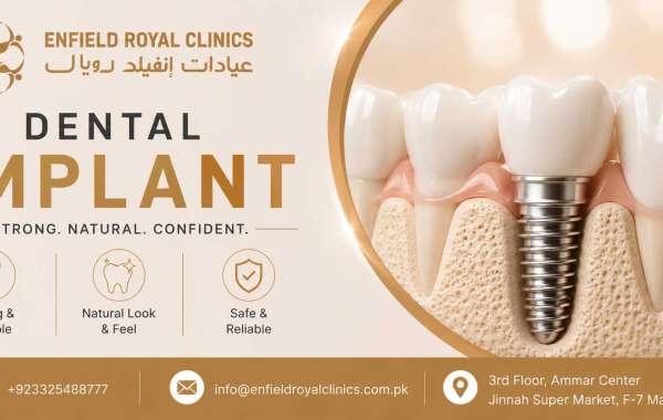 Can Dental Implants Improve Your Smile?