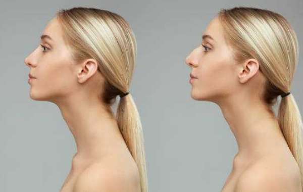 Riyadh Rhinoplasty Care: Clinic Information