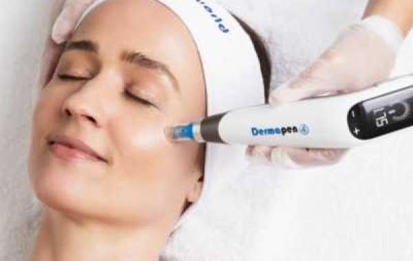 Microneedling with PRP in Islamabad