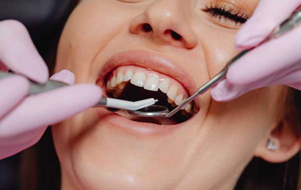 Why Interdental Decay Happens Even If Your Teeth Look Perfectly White