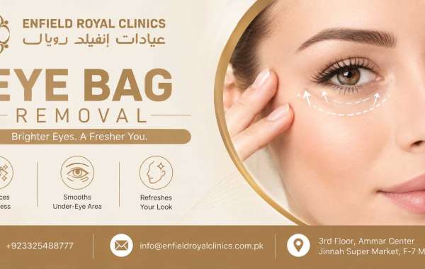 Can Eye Bag Removal Improve Facial Symmetry?
