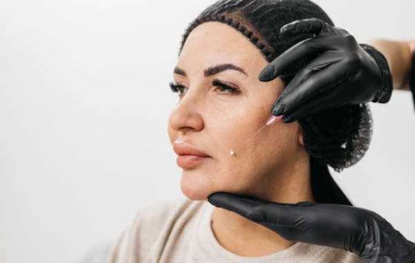 Jawline Filler Injections in Dubai vs Jawline Surgery: Which Fits?