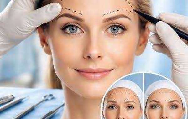 Can a Forehead Lift Improve Uneven Eyebrows?