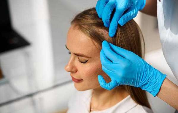Frontline Hair Fixing in Dubai | Expert Hairline Restoration at Tajmeels Clinic