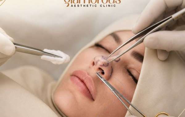 What Should I Avoid Before and After Rhinoplasty Surgery?