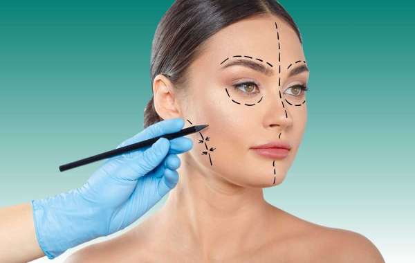 Can Eyelid Surgery in Islamabad Be Combined With Other Procedures?