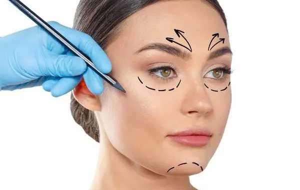 Top-Ranked Clinics for Eyelid Surgery Dubai Price