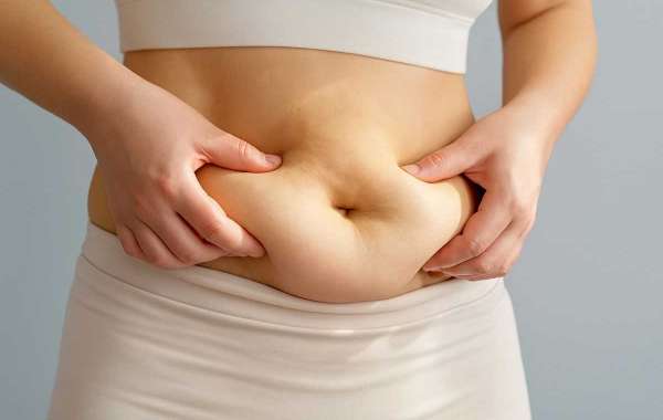 Non-Surgical Fat Reduction for a More Balanced Body Shape