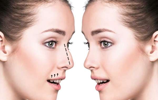 What Factors Influence Nose Surgery in Dubai Treatment Results?