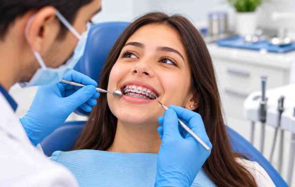 Braces Treatment in Surat: What Patients Should Know Before Starting